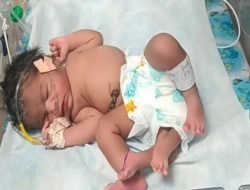 Wanita di Madya Pradesh India Melahirkan Bayi Berkaki 4